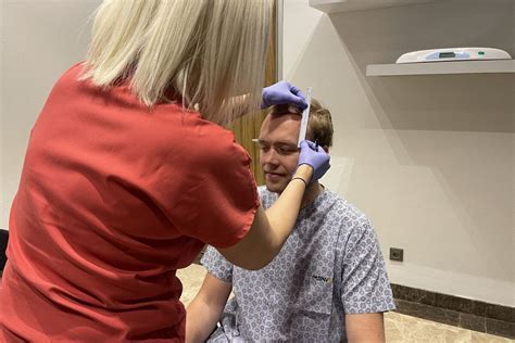 Haartransplantatie: Belangrijke Vragen Beantwoord